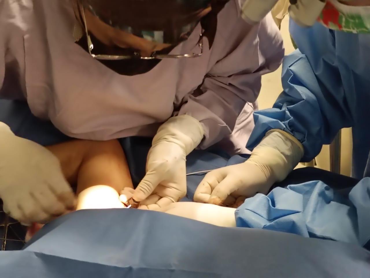 Instala SESA quinto Catéter Subcutáneo totalmente implantado; Querétaro.